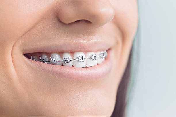 Best Dental Fillings (Composite and Amalgam)  in Rossville, MD